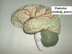 Posterior cerebral artery