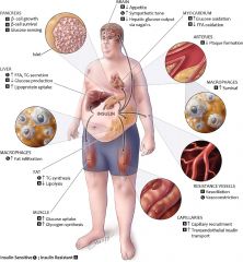 What is the exact cause of metabolic syndrome