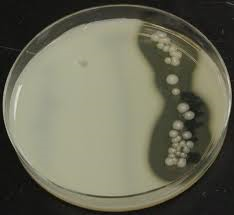 Casein is the most abundant protein in milk
Some bacteria are able to hydrolyze casein by means of the enzyme CASEINASE.

Examine the area around your streak line on the skim milk agar (casein agar).  If there is a clear zone surrounding your s...
