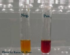 Add VP1 and VP2 to the MRVP tube ..

a pink or rose color indicates a + reaction
No change or yellowish  -