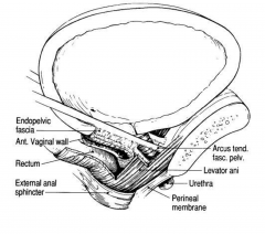 Immediately superior to the pelvicdiaphragm is the endopelvic fascia. Theendopelvic fascia is continuous withendoabdominal (transversalis) fascia andcontains multiple thickenings which helpto support pelvic viscera.										


Diaphragm and endop...