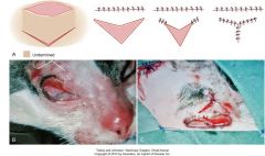 indicated for closing defects that are chronic and surrounded by inelastic skin and closing wounds in areas that could be easily distorted if under tension (near eye)