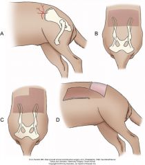 cranioventral to ilial wing, and then divides in dorsal and ventral branches (both can be used for flaps)

dorsal flap: ipsilateral flank, lateral lumbar, pelvic, lateromedial thigh, over greater trochanter.

ventral: lat abd wall, pelvic, sacral

s
