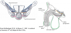  The superficial perineal fascia is continuous with dartos fascia of scrotum, superficial
penile fascia (labia majora) and mons pubis, and membranous layer of superficial fascia
of abdominal wall (green). Attaches to the posterior edge of the p...