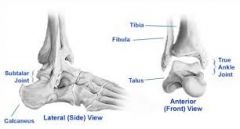 


Pronation is arch flattening. Supination is high arches at the subtalar joint