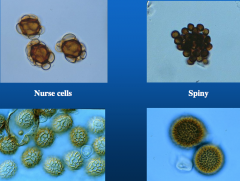 nurse cell (telia with bubbles) (onion)
reticulate (covered smut)

spiny (corn)