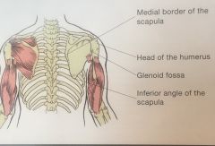 Protrusion of the vertebral (medial) border outward