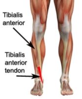 - more common in men (elderly)
- Insidious onset of slowly progressive proximal and distal weakness, often leads to a delay in diagnosis
- There is early weakness and atropy of the quadriceps, forearm flexors, and tibialis anterior muscles. Invo...