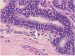Breast ducts are normally lined by ____- cell layer of epithelial cells overlying a layers of ______ cells. The arrow points to which layer?