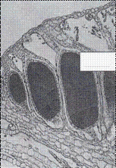 Bryophyta
Liverwort
Marchantia
Mature antheridium