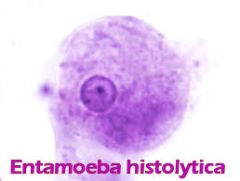 Entamoeba histolytica (trofozoito)