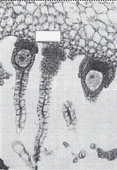 Bryophyta
Liverwort
Marchantia
Fertilized archegonium
