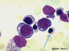- Stage: 3rd
- Cell size: small (slightly larger than mature RBC)
- Nucleus: small, round, eccentrically located, very condensed chromatin
- Cytoplasm: cytoplasm staining identical to that of mature RBC