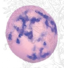- Stain w/ a supravital dye (eg, cresyl blue) 
- Residual polyribosomes stain blue