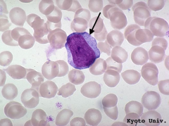 Myeloblast 

- Stage: 1
- Cell size: large
- Nucleus: large, round, occupies the majority of the cell volume, delicate chromatin, prominent nucleoli
- Cytoplasm: thin rim of light blue cytoplasm
