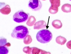 Myelocyte

- Stage: 3
- Cell size: large
- Nucleus: not indented
- Cytoplasm: specific granules present
