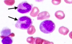 Band / Stab Cells

- Stage: 5
- Cell size: approximately same as mature cell
- Nucleus: horseshoe-shaped / deeply indented (>1/2 of diameter)
- Cytoplasm: pink granules