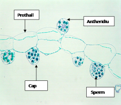 ProthallusAntheridium
Cap cell
Sperm cell