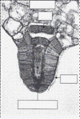 Ferns
Leptosporangiate
Female prothallus bearing an archegonium