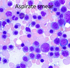 What is the predominant cell lineage in this aspirate smear?