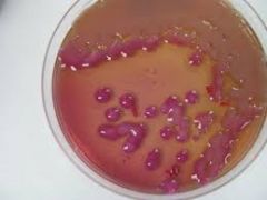 growth on MacConkey's agar plate - pink lac fermenter