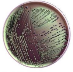 growth on EMB agar plate - Metallic sheen