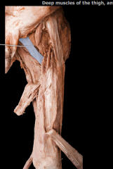 Anterior thigh, lateral to adductors