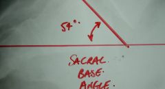 Sacral Base Angle