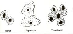 -Renal


 


-Squamous


 


-Transitional