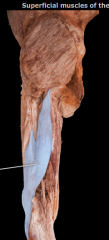 Posterior thigh, lateral