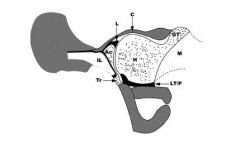 Illustration A depicts an ultrasound with structures abbreviated. Illustration B is a cartoon schematic of the hip. Il:ilium, Ac:acetabulum, L:labrum, G:gluteal muscles, C:capsule, GT:greater trochanter, H:femoral head, LT/P:ligamentum teres/pulvi...