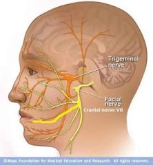 CN VII = facial nerve

Arises from the cerebellopontine angle, lateral to the abducens nerve (CN VI - quite close to midline) & medial to the vestibulocochlear (CN VIII) nerve.
Passes through the internal acoustic meatus & enters the facial canal...