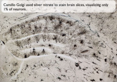 Used a thin slice of brain tissue and immersed it in a solution of silver nitrate

This showed fewer than 1% of the cells that were stained 