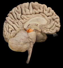 What part of the brainstem is this?