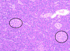 Which of the following are true: 
a. These are pancreatic acini.
b. These are Islets of Langerhans (pancreatic islets). 
c. They release their secretions directly into the blood stream via capillaries. 
d. These are the exocrine cells of the pancr...