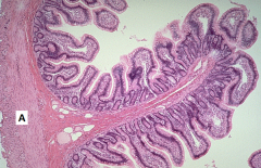 Which tissue layer (tunic) of the small intestine is represented here by the letter 'A'