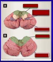 Identify: anterior lobe, flocculonodular lobe, posterior lobe