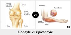 Condyles are anterior, and epicondyles are medial and lateral