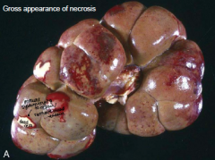 Pale foci of necrosis cause by schema surrounded by a zone of hyperaemia (inflammatory response) 