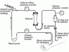 1. the patient's blood is pumped by an artificial pump outside of the body through the dialyzer, which typically consists of fine capillary networks of semipermeable membranes. The dialysate flows outside of these netowrks and fluid and soluted di...