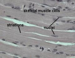 nuclei, striations, sarcolemma (cell membrane)