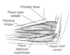 - Flexor-pronator mass includes 
Pronator Teres (median n.)  
Flexor Carpi Radialis (median n.)  
FDS (median n.)  
Palmaris Longus (median n.)  
Flexor Carpi Ulnaris (ulnar n.) Medial Epicondylitis (Golfer's Elbow) =pronator teres (PT) and flexor...