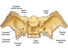   Sphenoid Bone