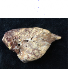 What disease is shown here? (lung)