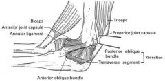 capsular release, 
 posterior band of the medial collateral ligament (MCL) should be released. 
LIGAMENT B ON MEDIAL VIEW