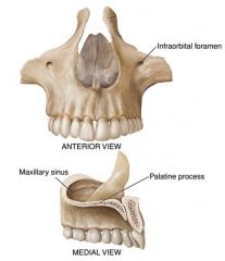 Maxillary Bones