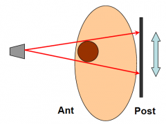 X-ray source anterior to subject, film flat against posterior surface.