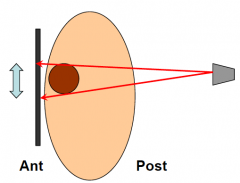 X-ray source posterior to subject, film flat against anterior surface.