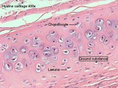 chondrocytes, lacunae, matrix
