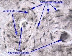 osteon/Haversion canal, canaliculi, lacunae, lamellae